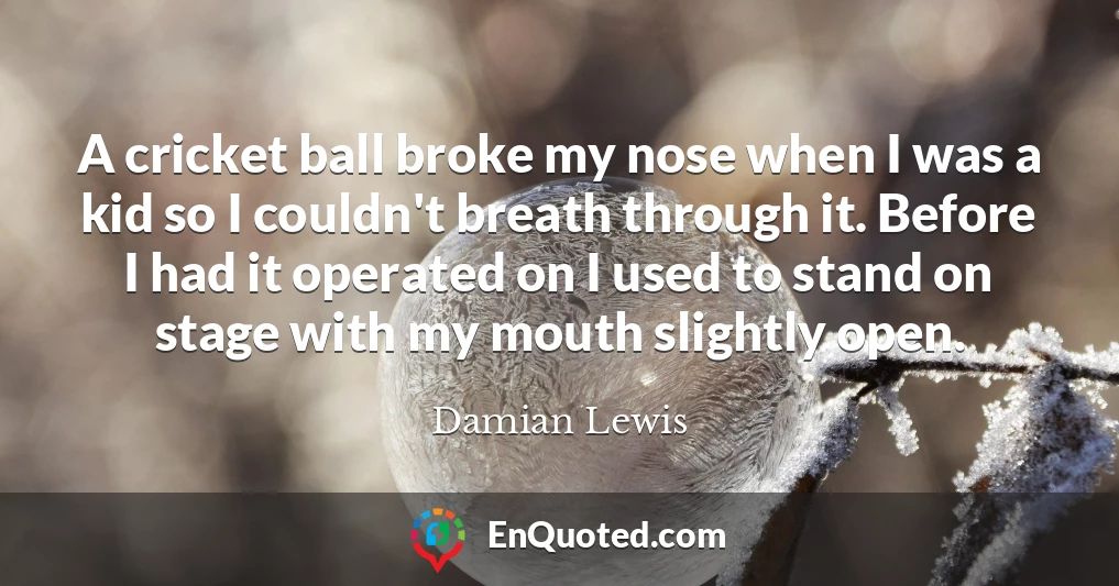 A cricket ball broke my nose when I was a kid so I couldn't breath through it. Before I had it operated on I used to stand on stage with my mouth slightly open.