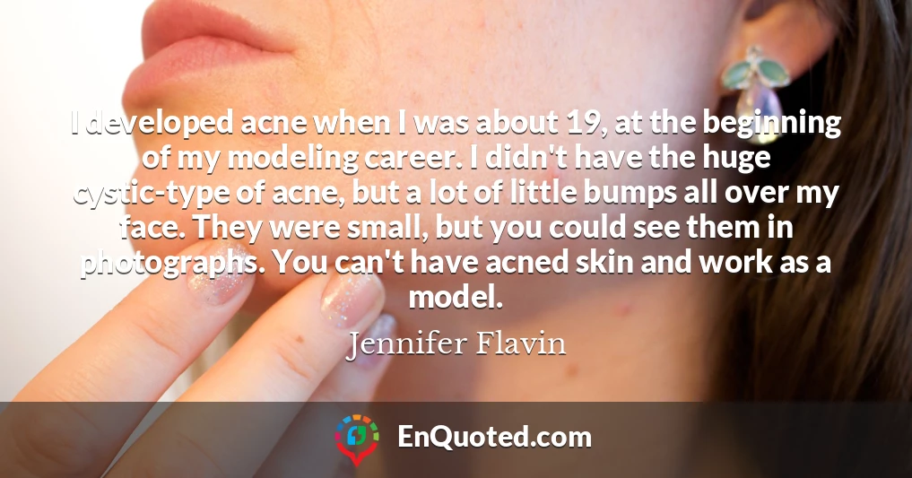 I developed acne when I was about 19, at the beginning of my modeling career. I didn't have the huge cystic-type of acne, but a lot of little bumps all over my face. They were small, but you could see them in photographs. You can't have acned skin and work as a model.