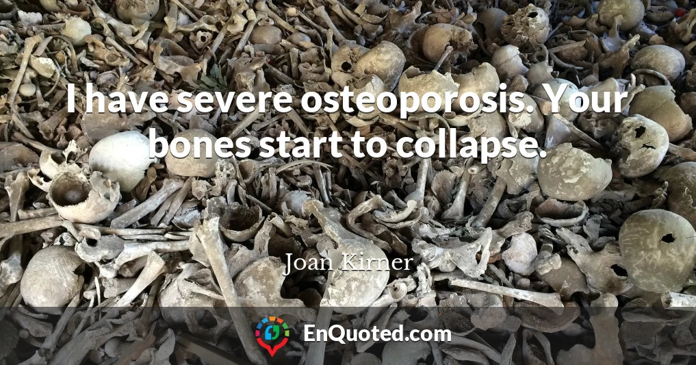I have severe osteoporosis. Your bones start to collapse.
