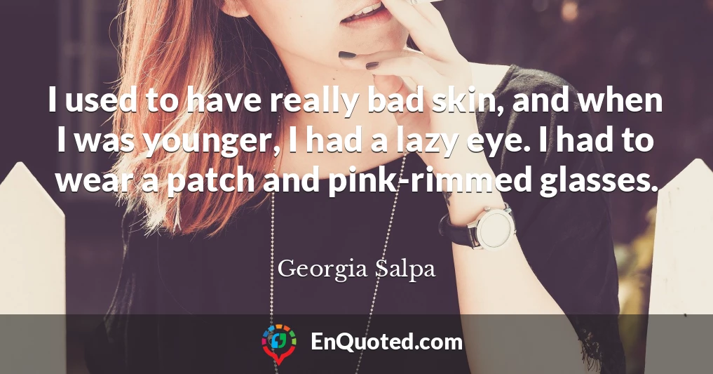 I used to have really bad skin, and when I was younger, I had a lazy eye. I had to wear a patch and pink-rimmed glasses.