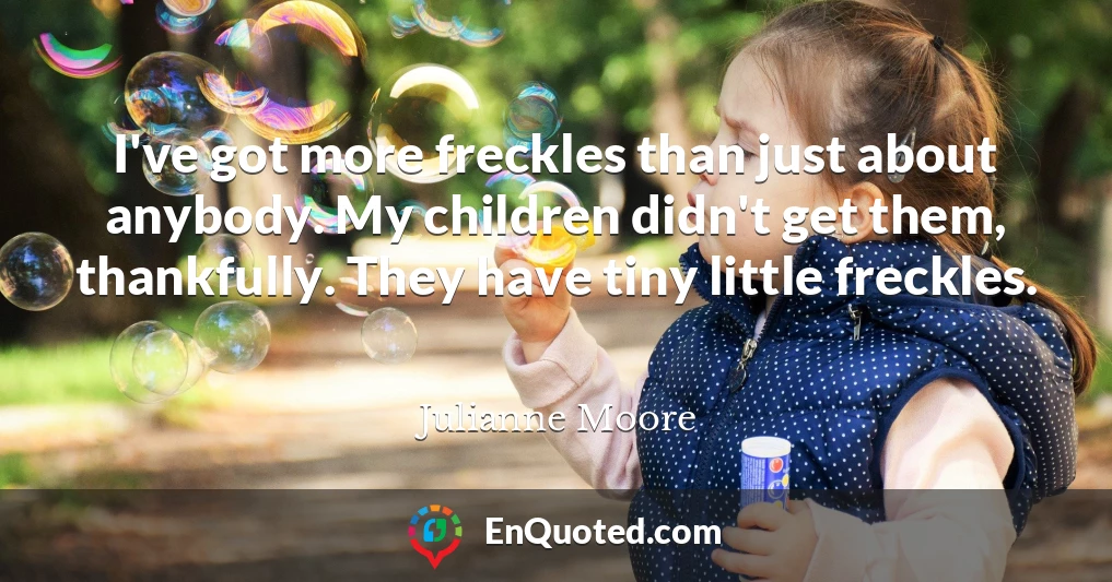 I've got more freckles than just about anybody. My children didn't get them, thankfully. They have tiny little freckles.