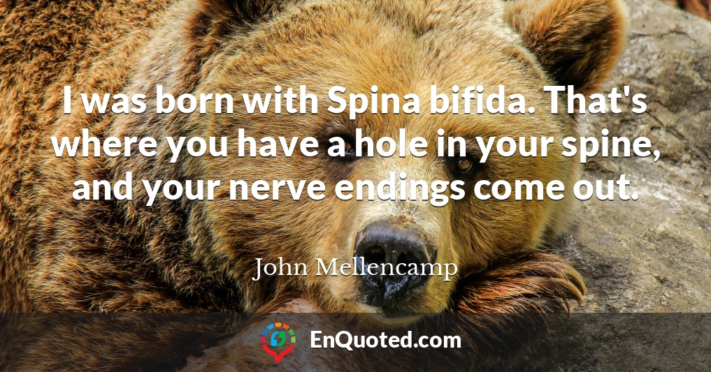 I was born with Spina bifida. That's where you have a hole in your spine, and your nerve endings come out.