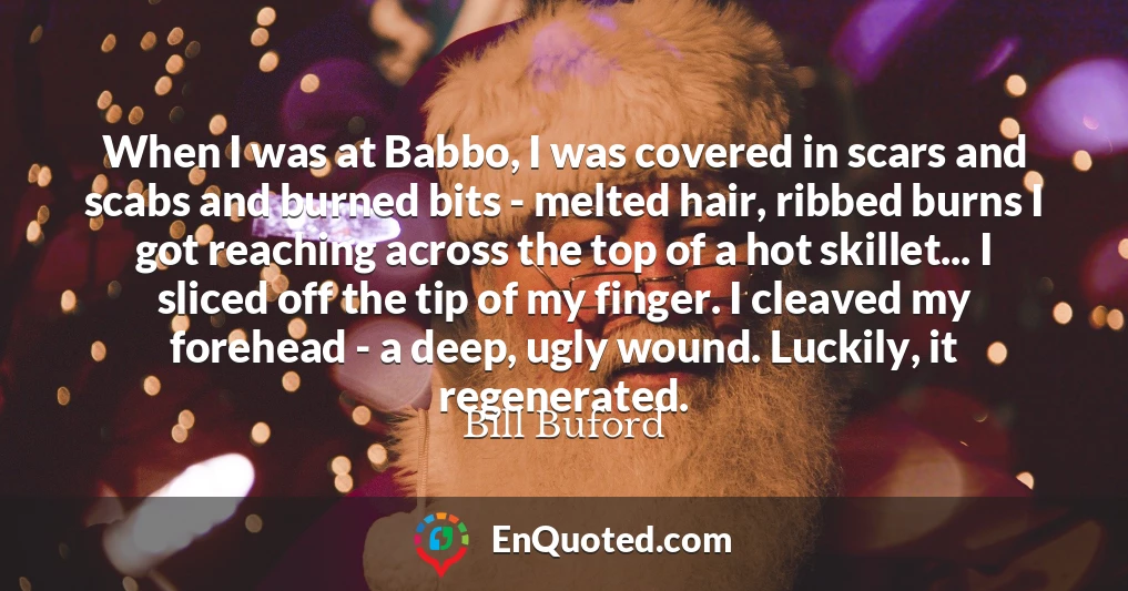 When I was at Babbo, I was covered in scars and scabs and burned bits - melted hair, ribbed burns I got reaching across the top of a hot skillet... I sliced off the tip of my finger. I cleaved my forehead - a deep, ugly wound. Luckily, it regenerated.